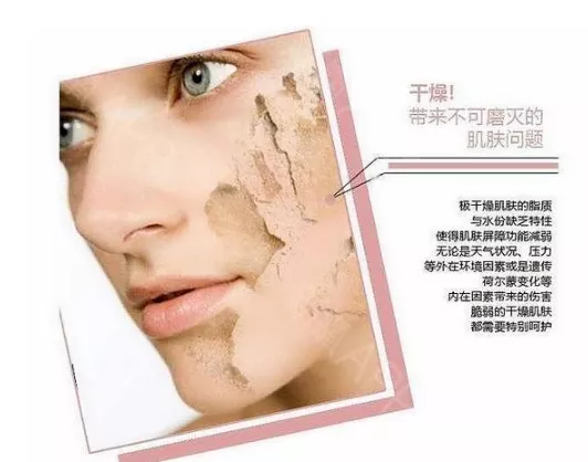 皮肤干燥 起皮擦护肤品就刺痛 奥缇妤漾护肤品私人定制